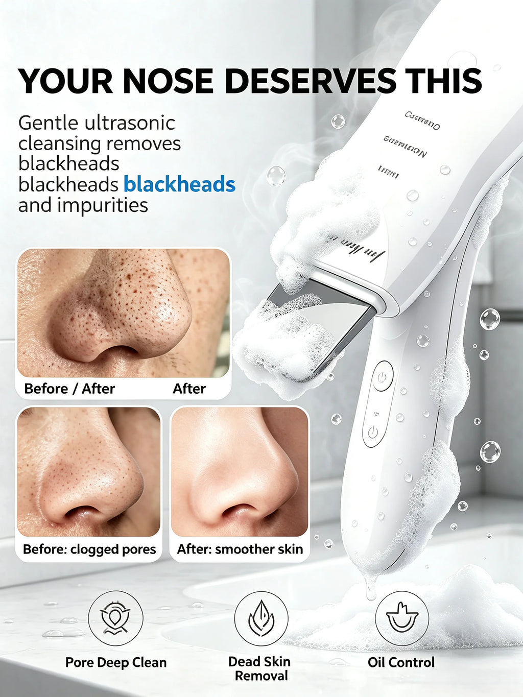 Ultrasonic Skin Scrubber – Pore Cleanser, Blackhead Remover & Facial Lifting Spatula