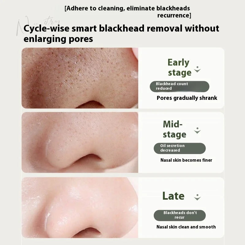 RUYI Himalayan Green Tea Pore Purifying Nose Mask - Gentle Painless Blackhead Removal