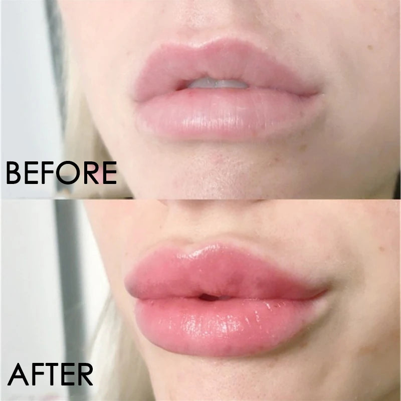 Karité SOS Lip Plump Active Serum | 5x Hyaluronic Acid & Argan Oil Volumizing Lip Gloss