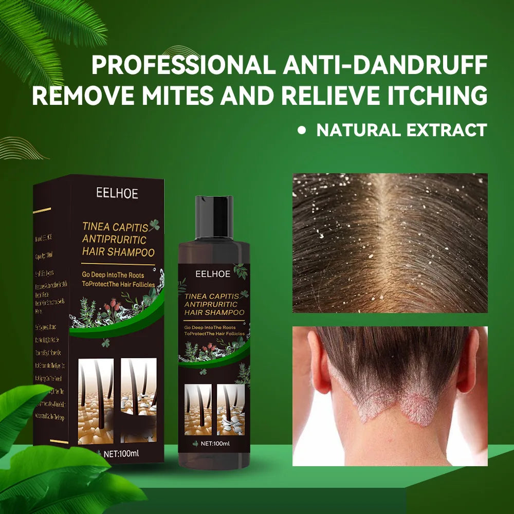 EELHOE Anti-Dandruff & Itch Relief Scalp Shampoo (100ml) – Deep Follicle Cleanser for Flaking, Scalp Ringworm & Follicle Care