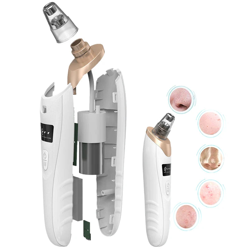 Electric Blackhead Remover Vacuum – 3-Speed Pore Extractor with 5 Interchangeable Suction Heads