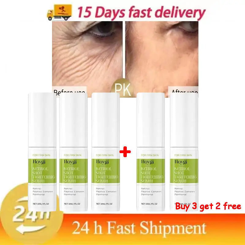 Hoygi Retinol Shot Tightening Serum 30 ml