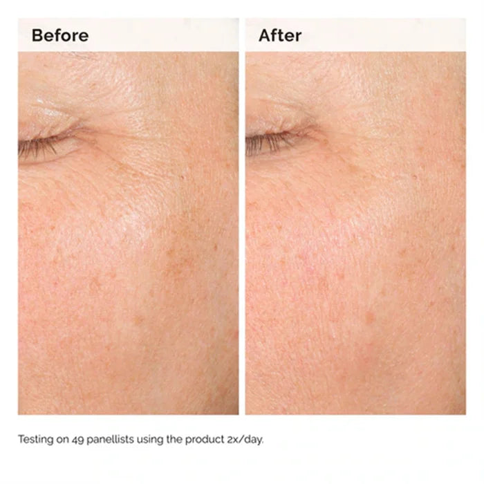 The Ordinary Alpha Arbutin 2% + HA Serum 30 ml