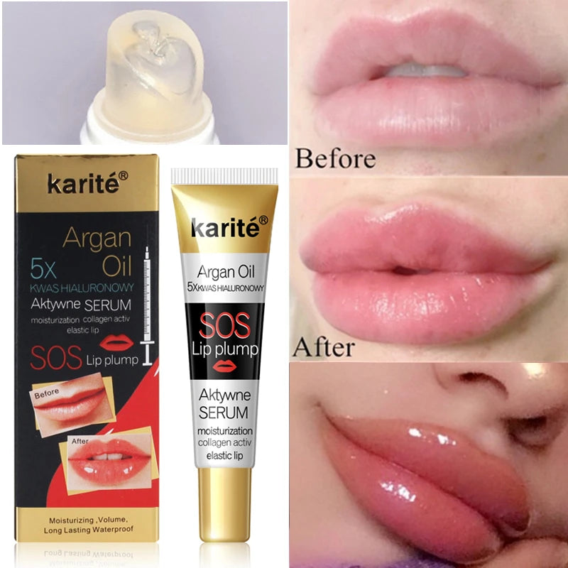 Karité SOS Lip Plump Active Serum | 5x Hyaluronic Acid & Argan Oil Volumizing Lip Gloss