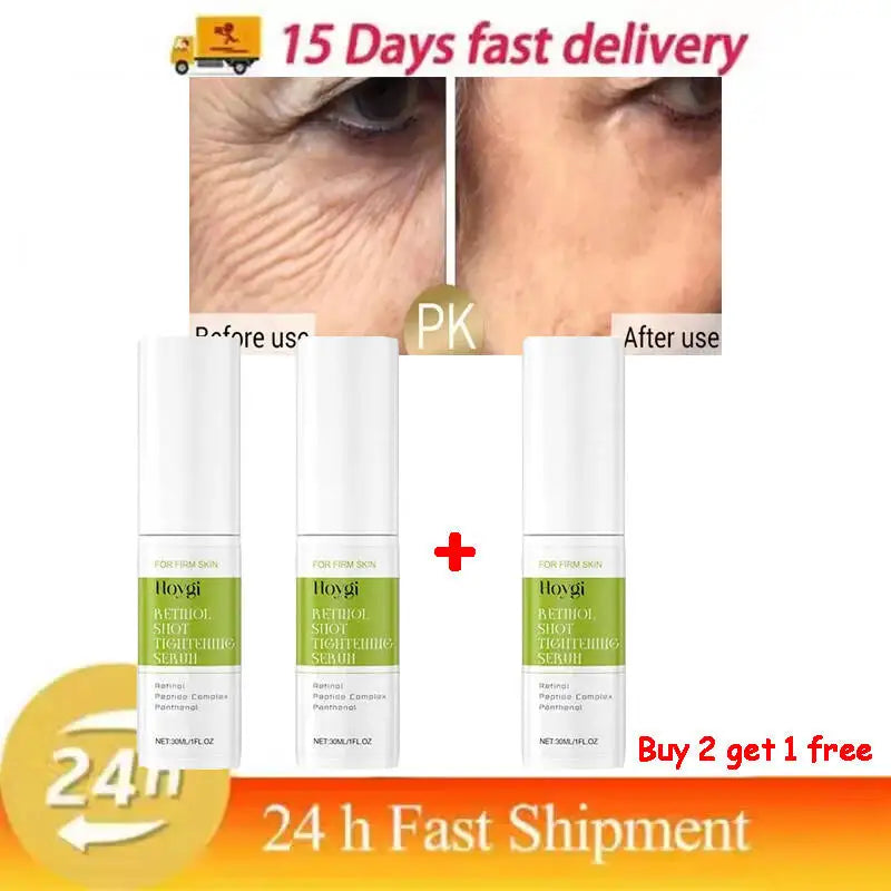 Hoygi Retinol Shot Tightening Serum 30 ml