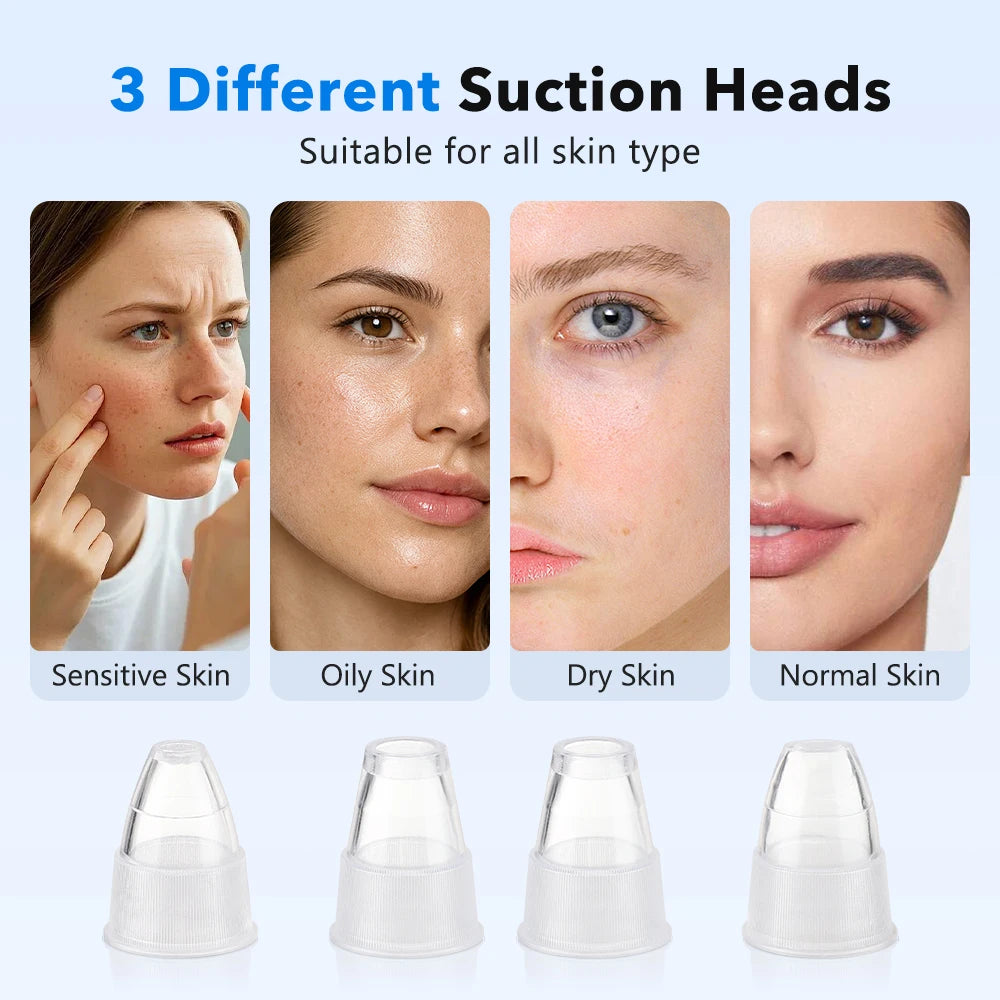 2-in-1 Smart Blackhead Remover Vacuum & Facial Pore Cleanser – Deep Pore Suction Device with 3-Level Heating Hot Compress
