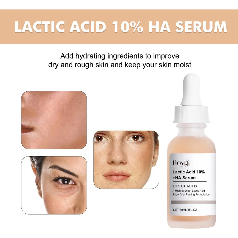 Hoygi Lactic Acid 10% + HA Serum – Exfoliating & Hydrating Face Peel (30ml)