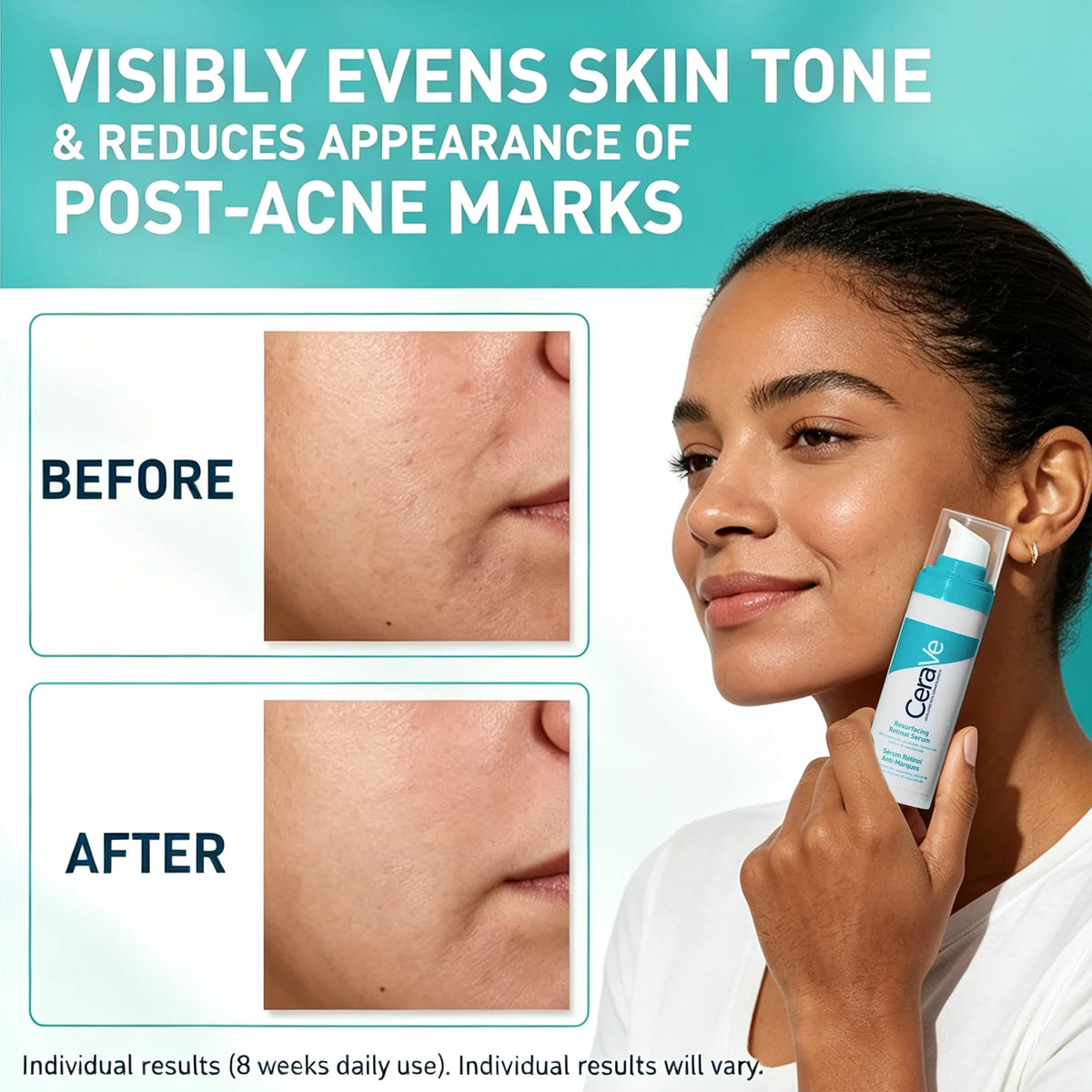 CeraVe Resurfacing Retinol Serum with Niacinamide & Ceramides