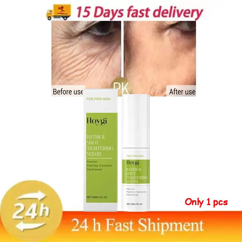 Hoygi Retinol Shot Tightening Serum 30 ml