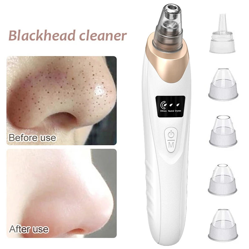 Electric Blackhead Remover Vacuum – 3-Speed Pore Extractor with 5 Interchangeable Suction Heads