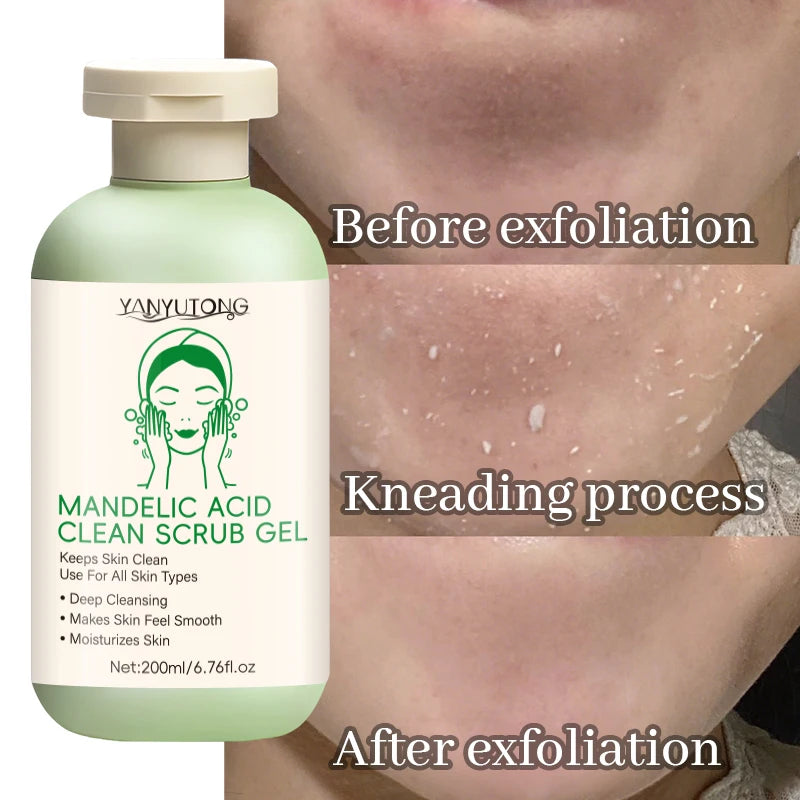YANYUTONG Mandelic Acid Clean Scrub Gel – Gentle Exfoliating & Deep Pore Cleansing Gel (200ml)