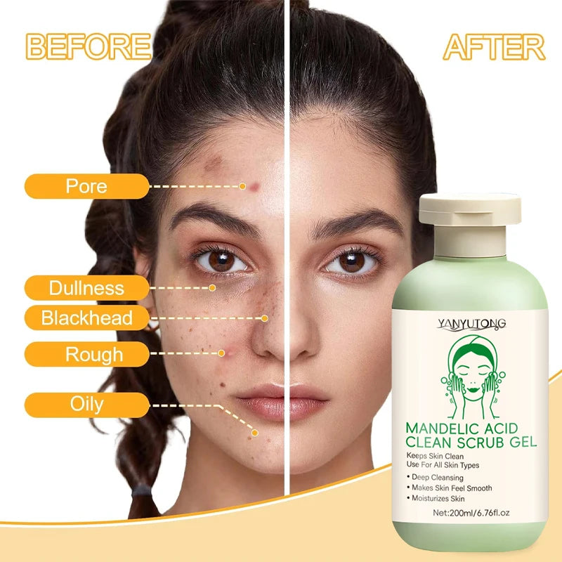 YANYUTONG Mandelic Acid Clean Scrub Gel – Gentle Exfoliating & Deep Pore Cleansing Gel (200ml)