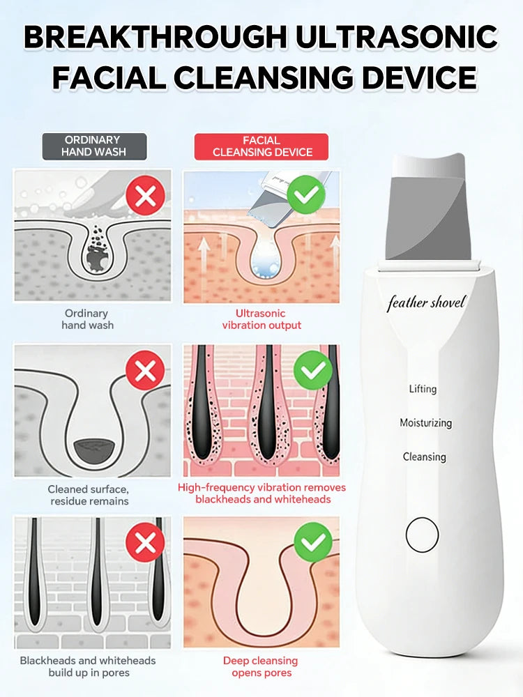 Ultrasonic Skin Scrubber – Pore Cleanser, Blackhead Remover & Facial Lifting Spatula