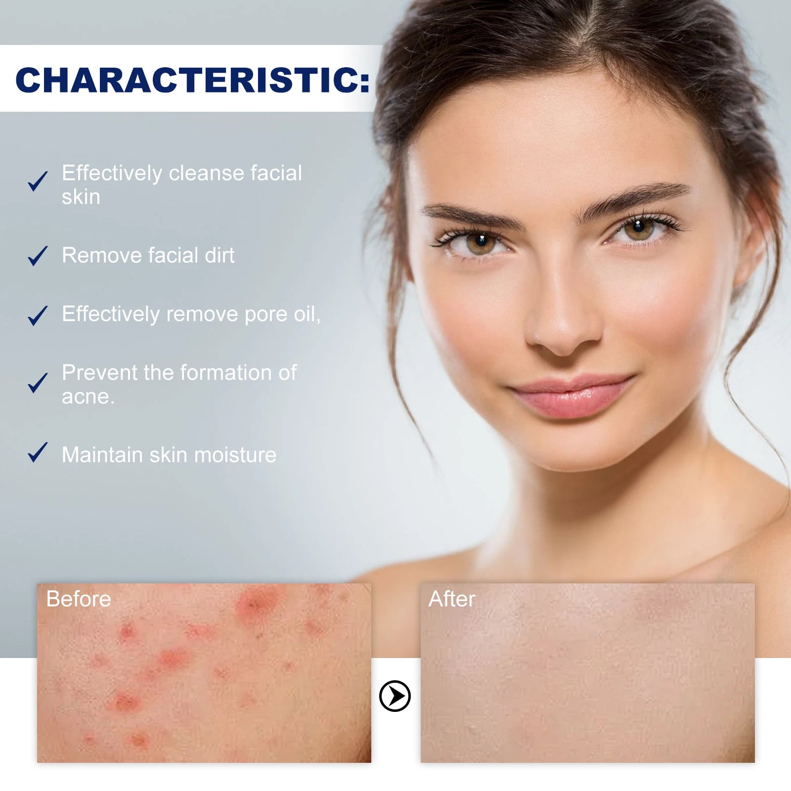Hoygi Acne Foaming Wash – 10% Tea Tree Oil Deep Pore Cleanser