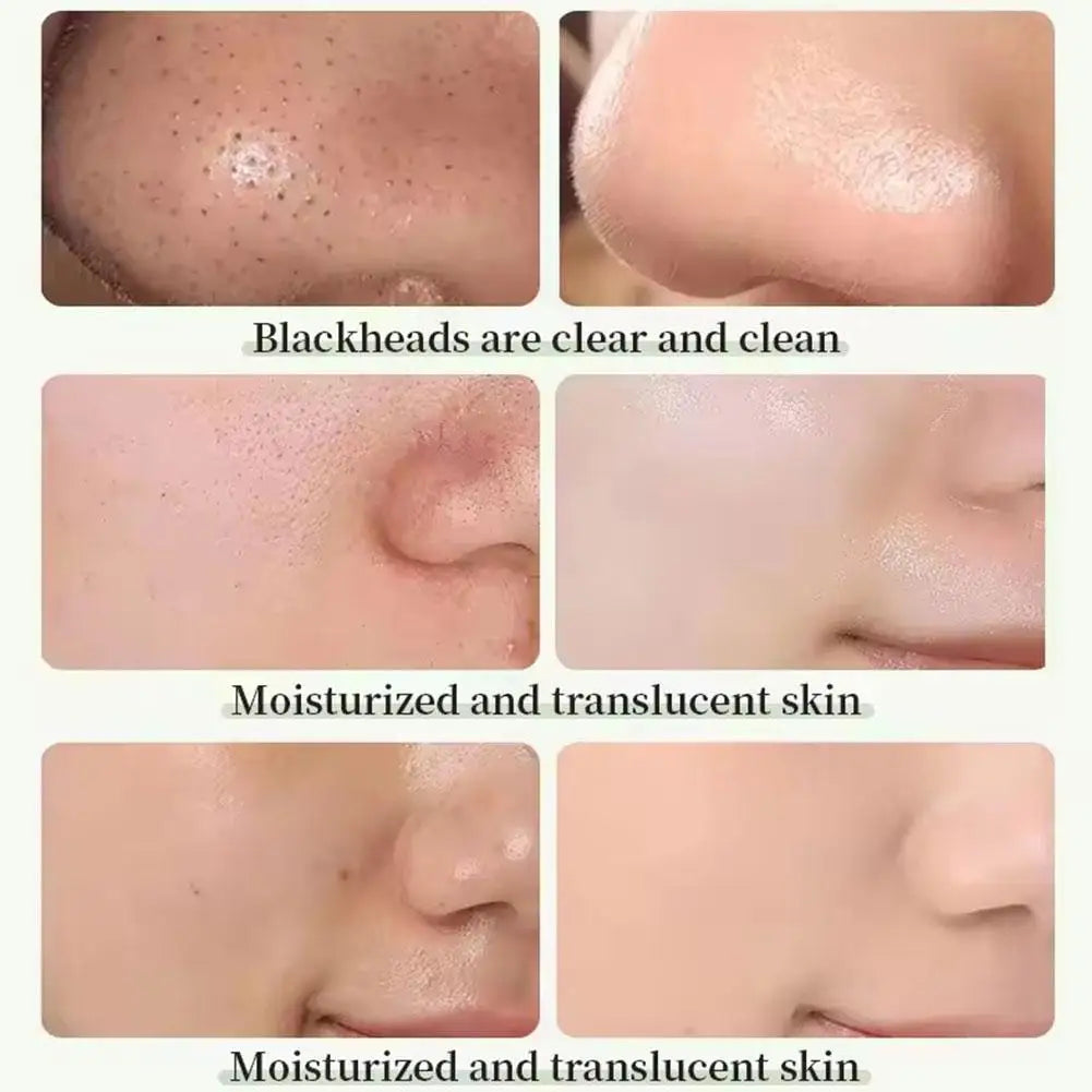 Green Tea Purifying Clay Mask Stick – Deep Cleansing Pore Minimizer & Blackhead Remover for Oily Skin