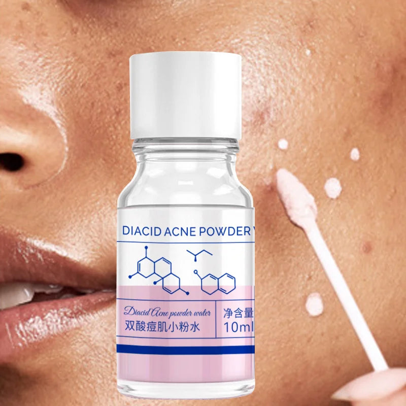 Diacid Acne Drying Lotion – Overnight Blemish Spot Treatment & Pore Clarifying Pink Powder (10ml)