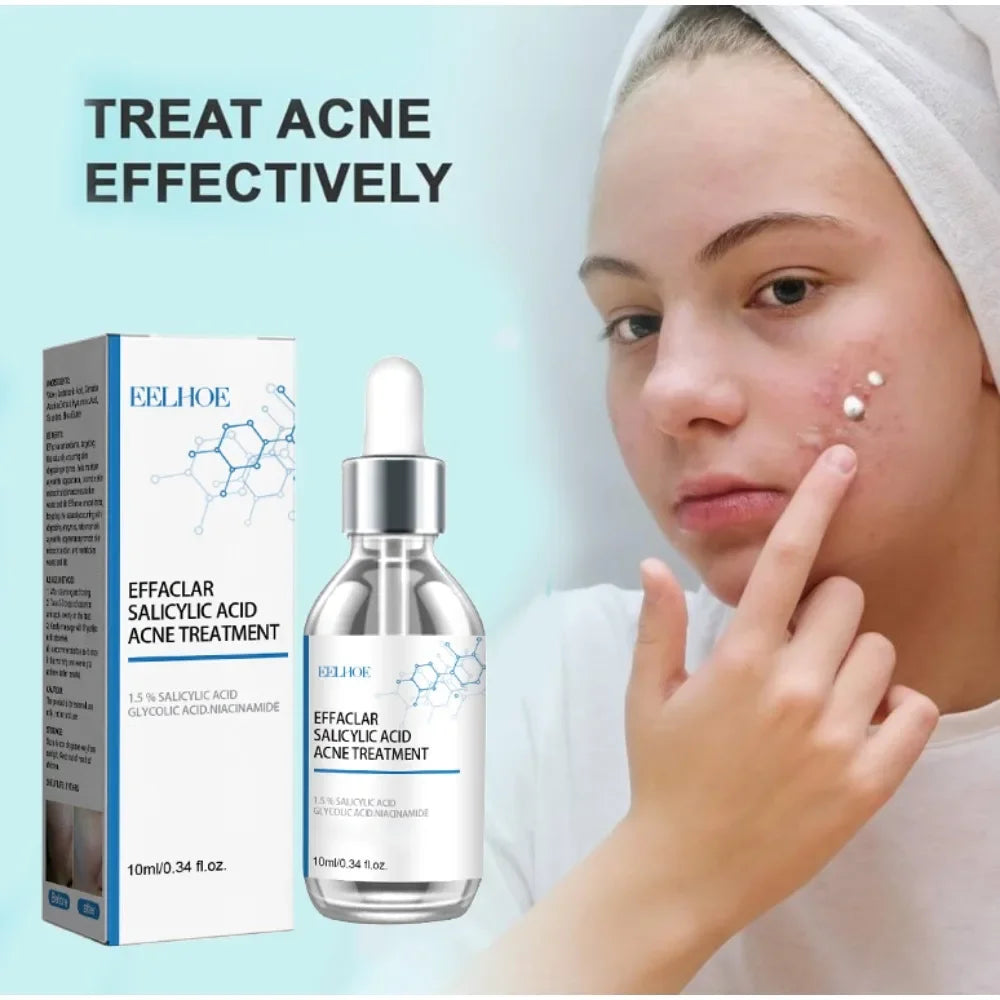 Salicylic Acid Clarifying Serum – Acne Clearing, Blemish & Pore Minimizing Essence with Niacinamide & Glycolic Acid