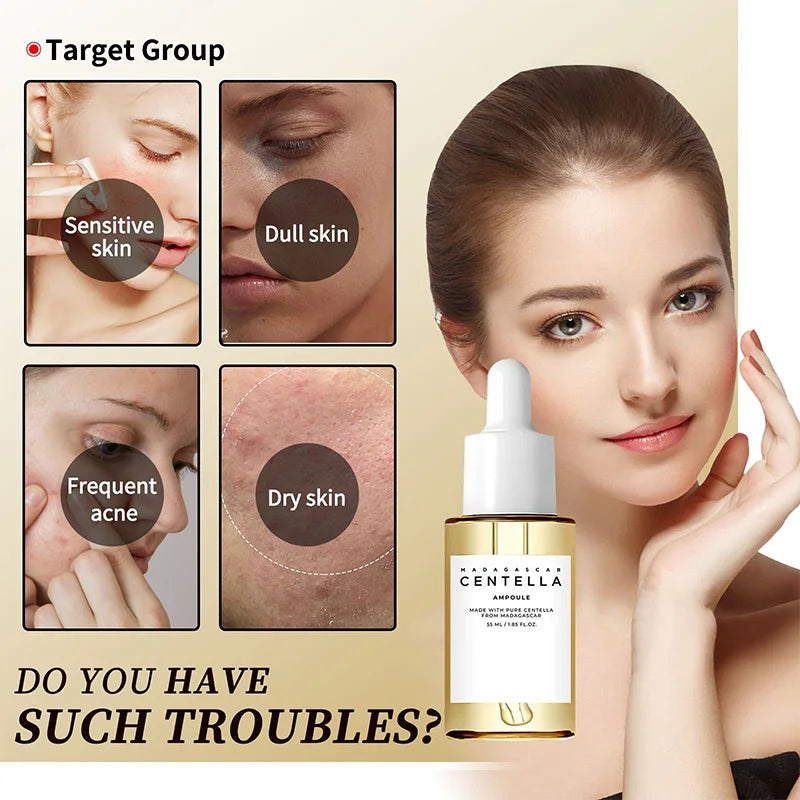 Madagascar Centella Facial Ampoule - Size & Pack Options