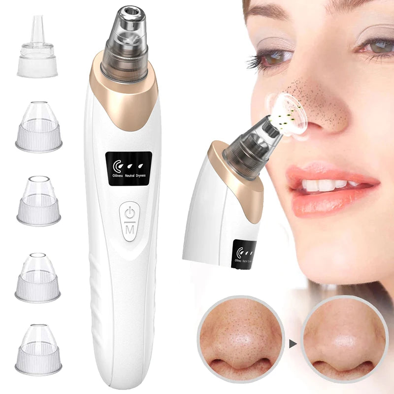 Electric Blackhead Remover Vacuum – 3-Speed Pore Extractor with 5 Interchangeable Suction Heads