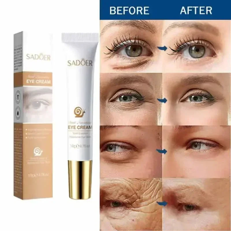 SADOER Snail Nourishing Eye Cream (20g)