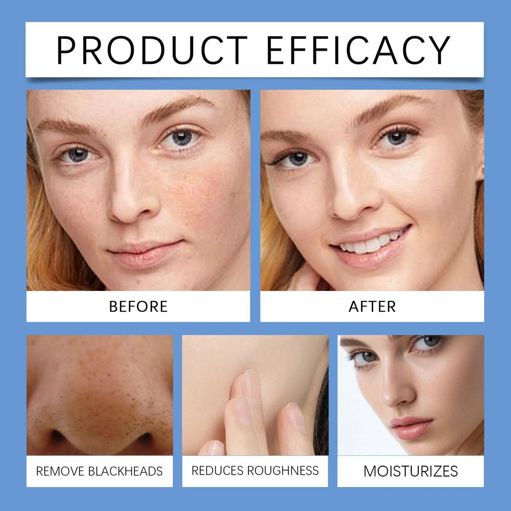 ZEPHOCO Clean Pore Blackhead Mud Mask with AHA+BHA+PHA (100g)