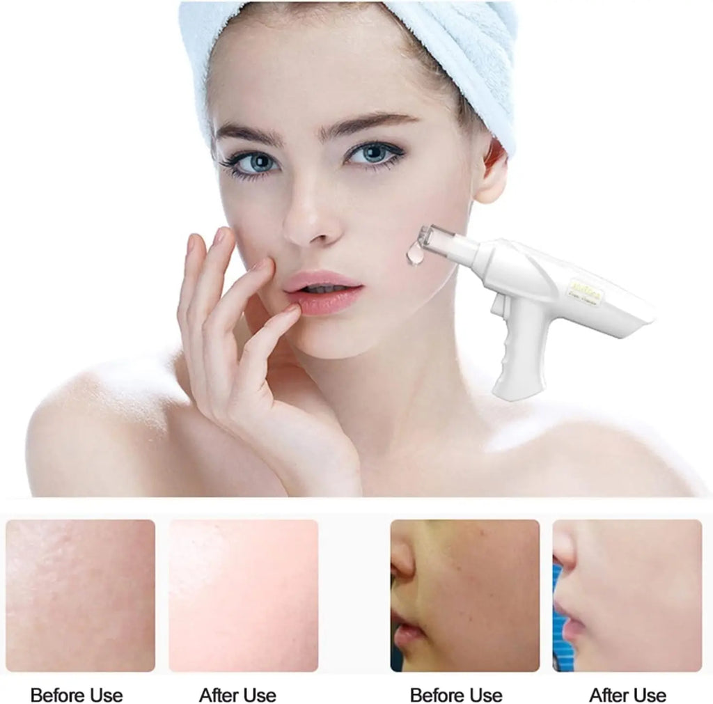 Professional Handheld Hydro-Mesotherapy Injection Gun – Nano-Microcrystal Skin Rejuvenation & Anti-Aging Device