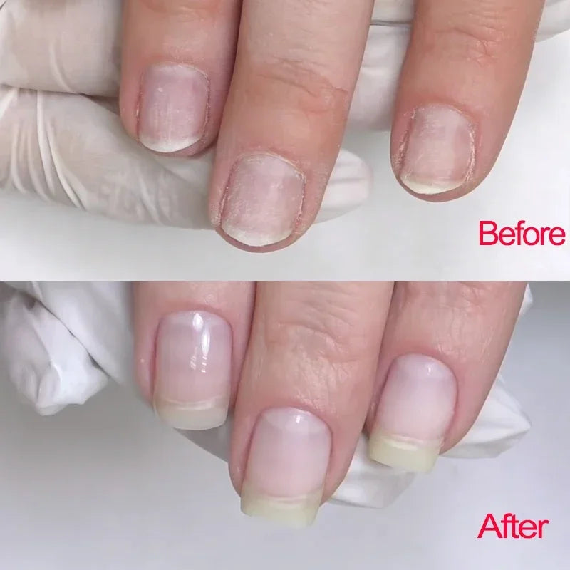 MSHARE Self-Leveling Builder Gel in a Jar – Medium Density Extension Gel for Nail Strengthening