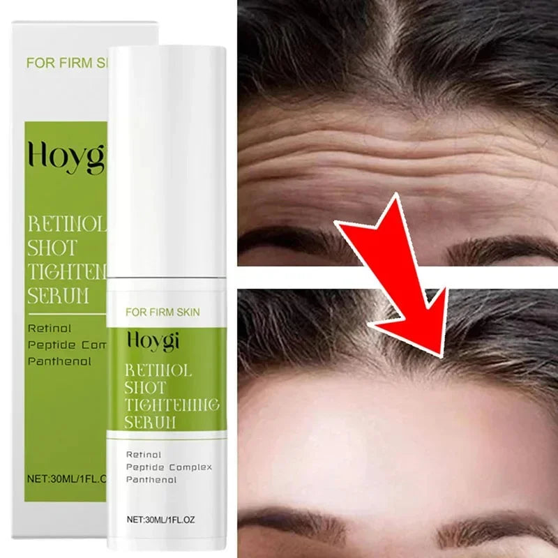 Hoygi Retinol Shot Tightening Serum 30 ml