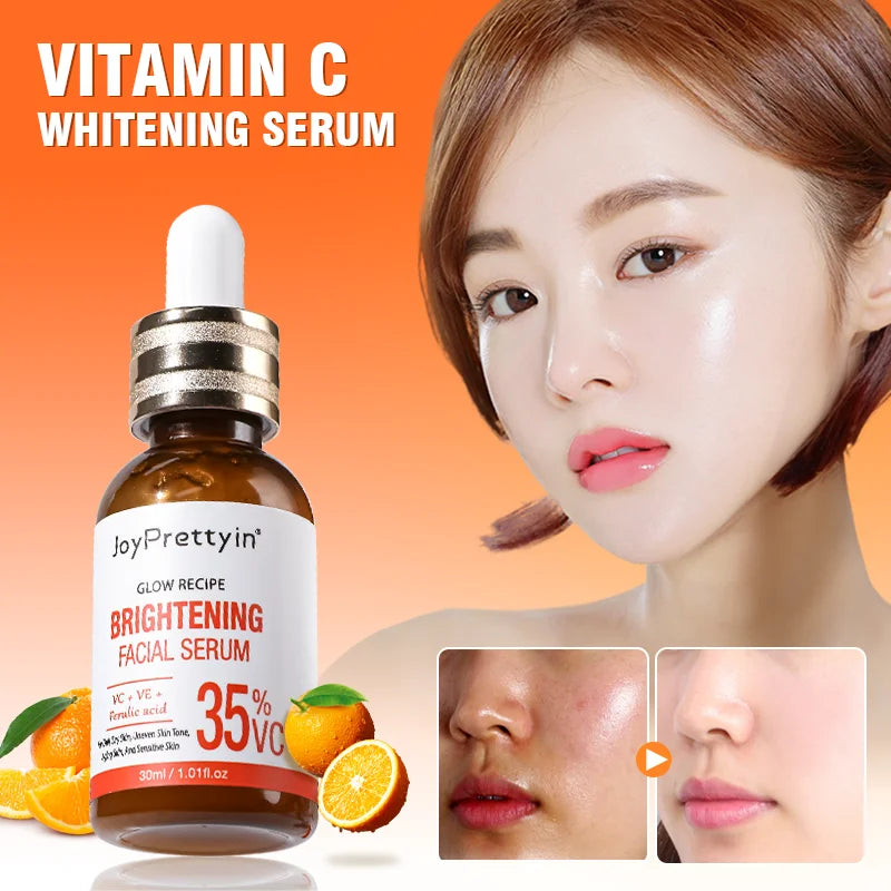 JoyPrettyin 35% Vitamin C Brightening Facial Serum – Dark Spot Corrector & Anti-Aging Face Serum with Vitamin E & Ferulic Acid (30ml / 1.01 fl oz)